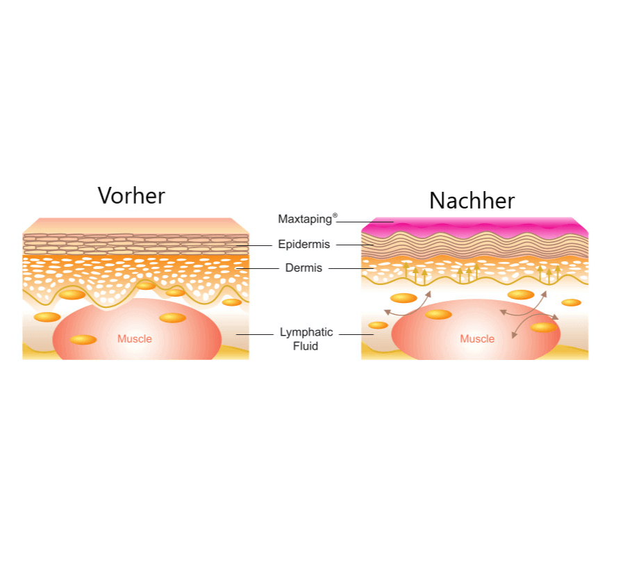 Maxtaping A+ / 8195BU/RD